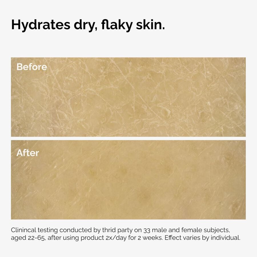 the-body-care-collection-y3 ord-natural-moisturizing-factors-inulin-body-before-after-graphic-02.jpg