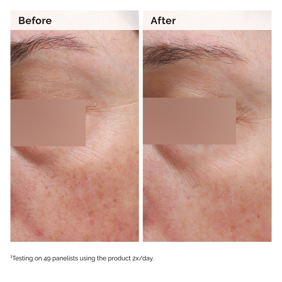 niacinamide-5-face-and-body-emulsion-t1 2024-08-23-ORD-Nia-5pct-Face-Body-B-A-Elasticity-Global-02-1x1.jpg