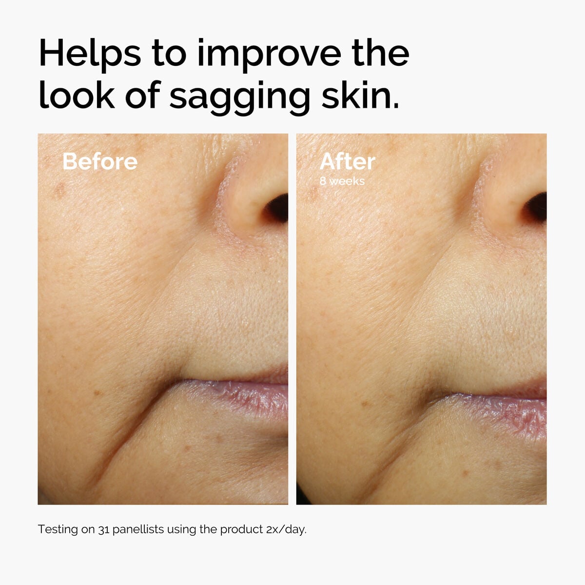 caffeine-3-escin-1-face-serum-d7 ord-caffeine-3pct-escin-1pct-face-serum-before-after-sagging.jpg