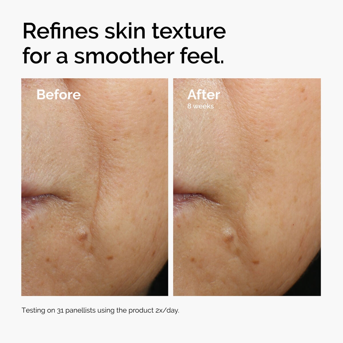 caffeine-3-escin-1-face-serum-d7 ord-caffeine-3pct-escin-1pct-face-serum-before-after-texture.jpg
