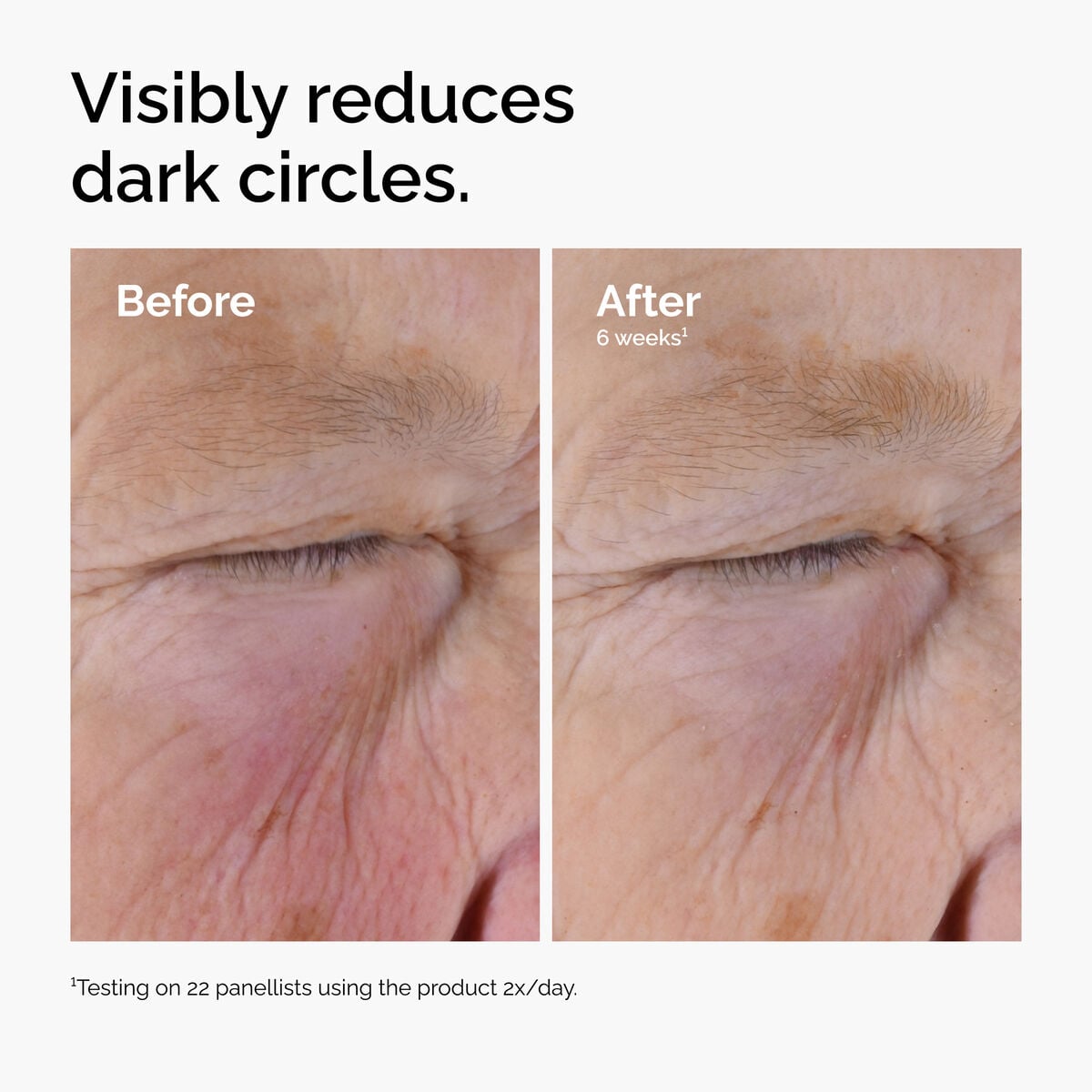caffeine-solution-5-egcg-eye-serum-t1 ord-caffeine-solution-egcg-dark-circles-before-after.jpg