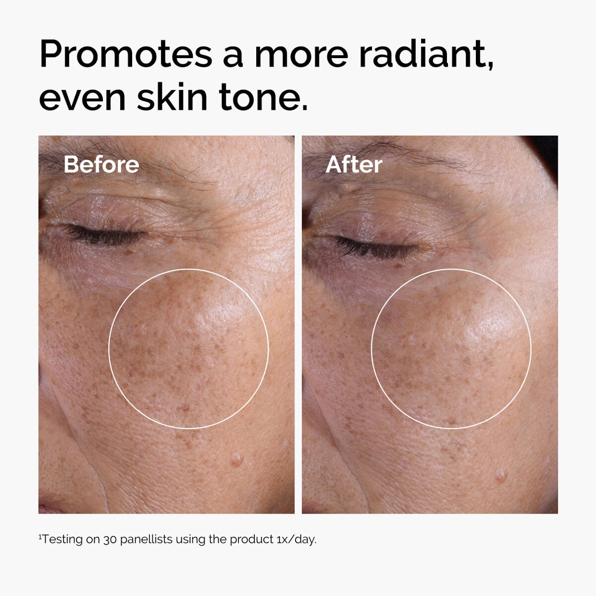 glycolic-acid-7-exfoliating-toner-i3 ord-glycolic-before-after-radiance.jpg