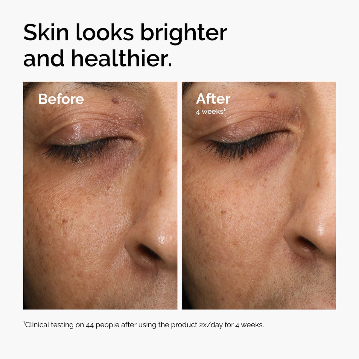 multi-antioxidant-radiance-serum-e7 ord-mars-before-after-healthy.jpg