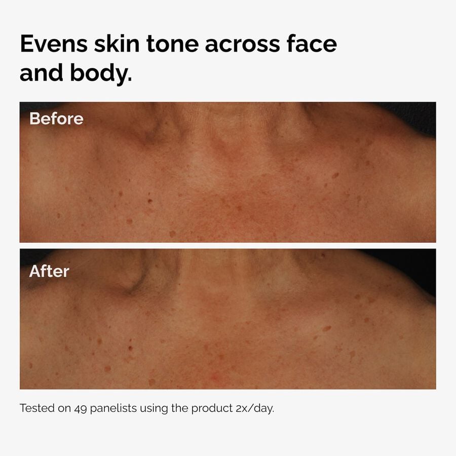 the-body-care-collection-y3 ord-niacinamide-face-body-serum-before-after-even-tone-graphic.jpg