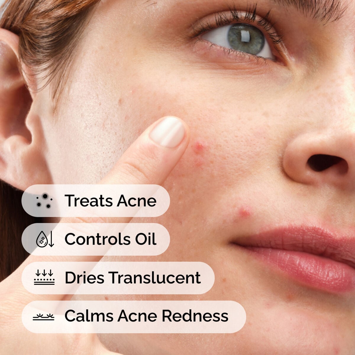 sulfur-10-powder-to-cream-concentrate-o4 ord-sulfur-10pct-powder-to-cream-concentrate-model-application-with-benefits-acne.jpg